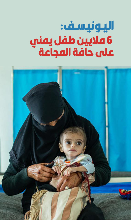  6 ملايين طفل يمني على حافة المجاعة